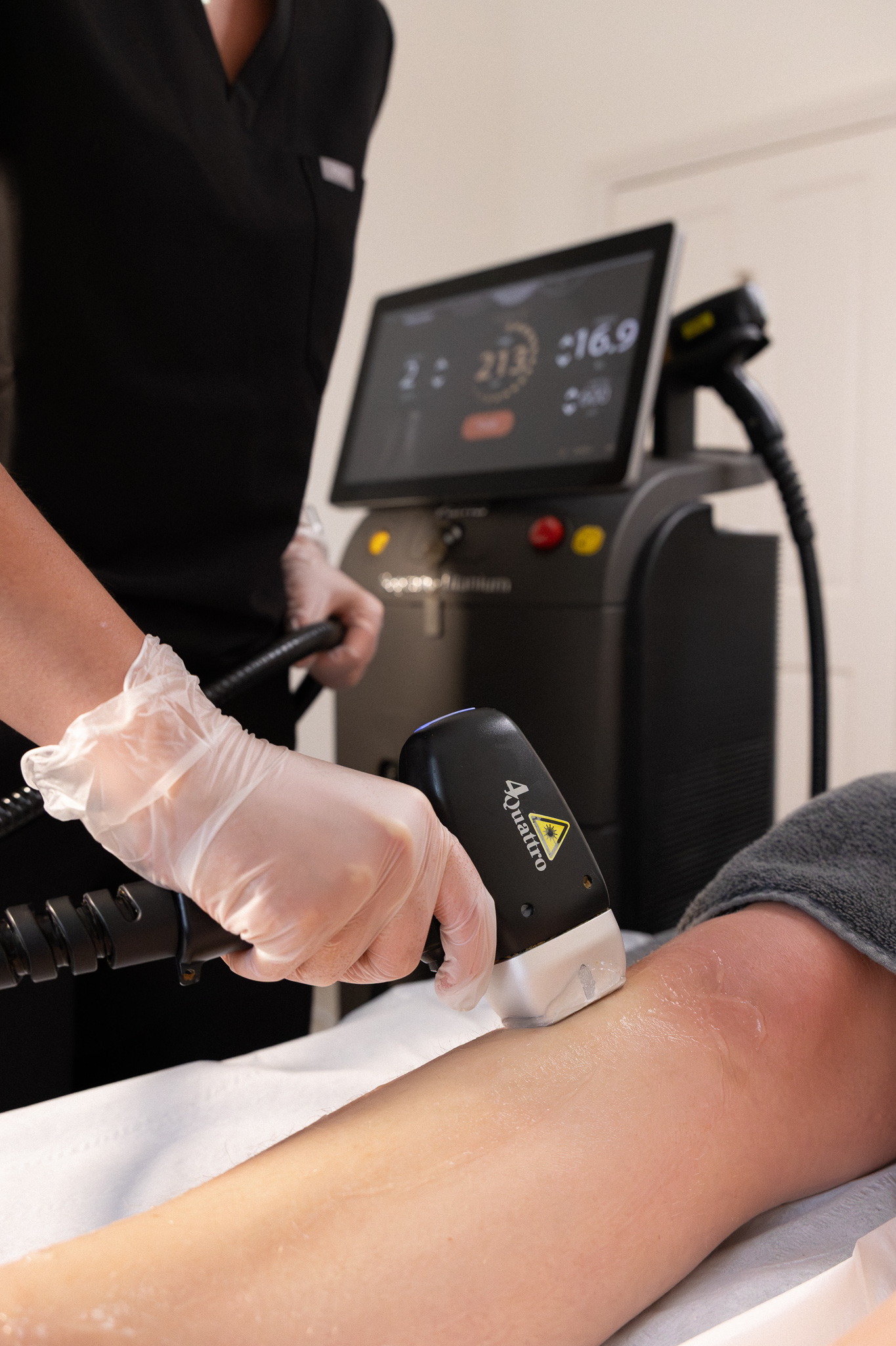 laser hair removal watford